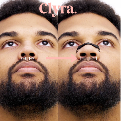 Snore-Free Magnetic Nose Strip Starter Pack